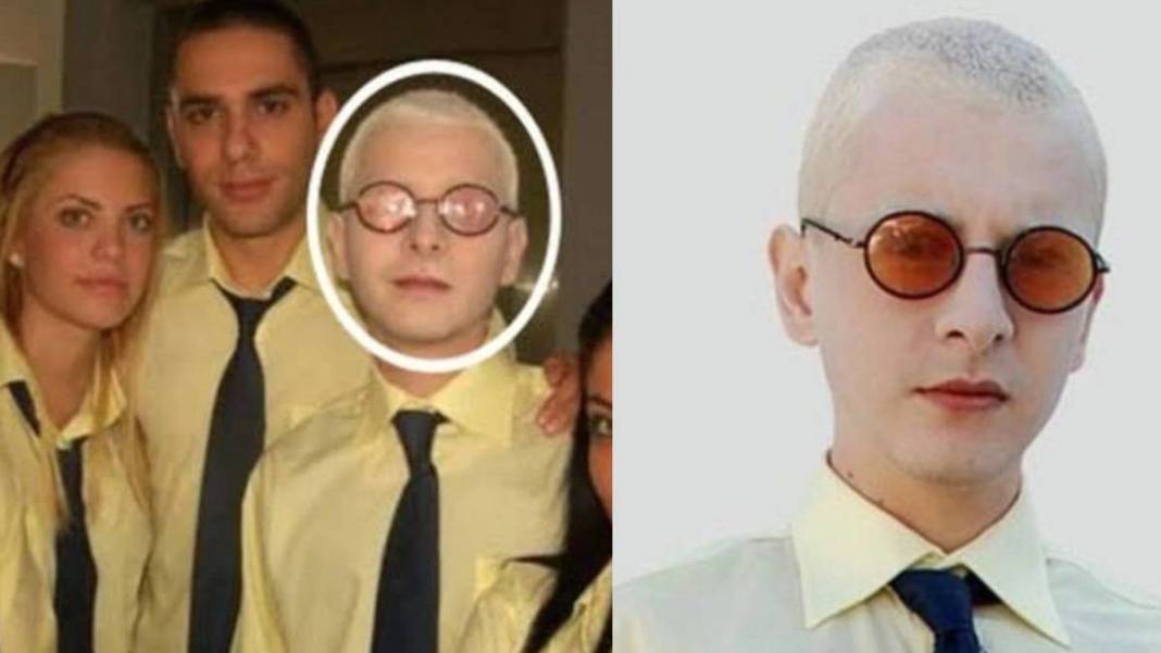 Pis Yedili dizisinin PC'si idi! Herkes onu albino hastası sanıyordu: Gerçek çok farklı çıktı! 1